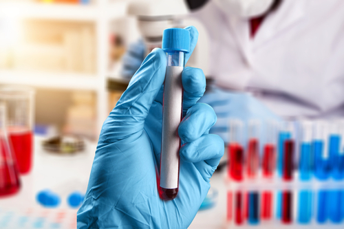 Picture of a hand in a glove holding up a test tube in a Laboratory.