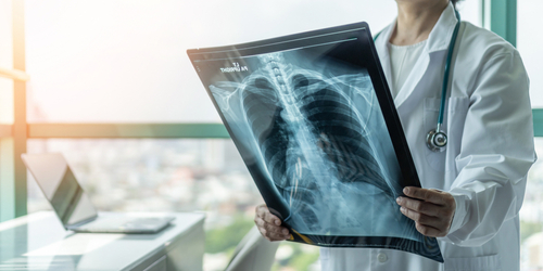 Picture of a Physician holding up a chest X-ray.